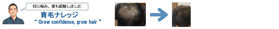育毛ナレッジ